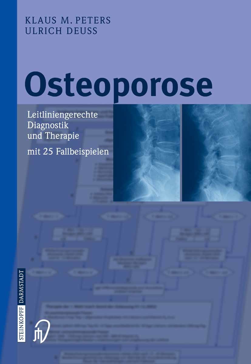 Cover Osteoporose