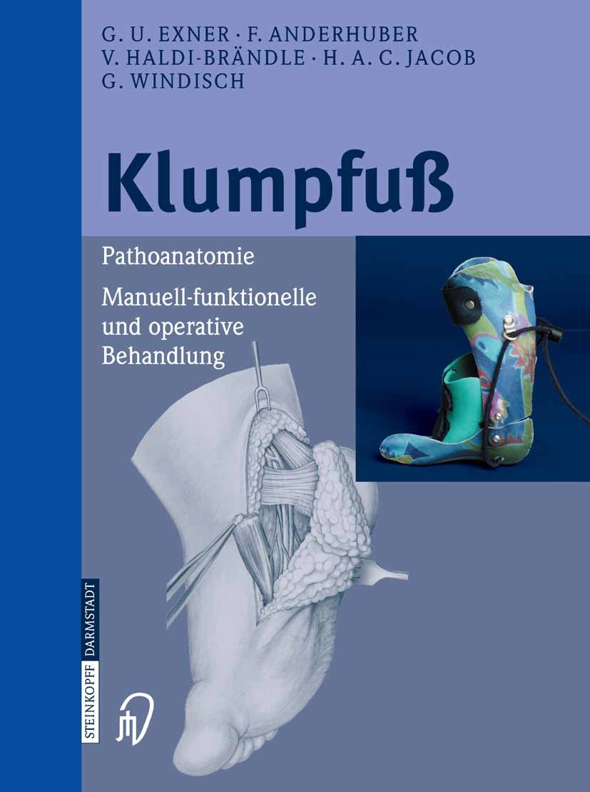Cover Klumpfuß