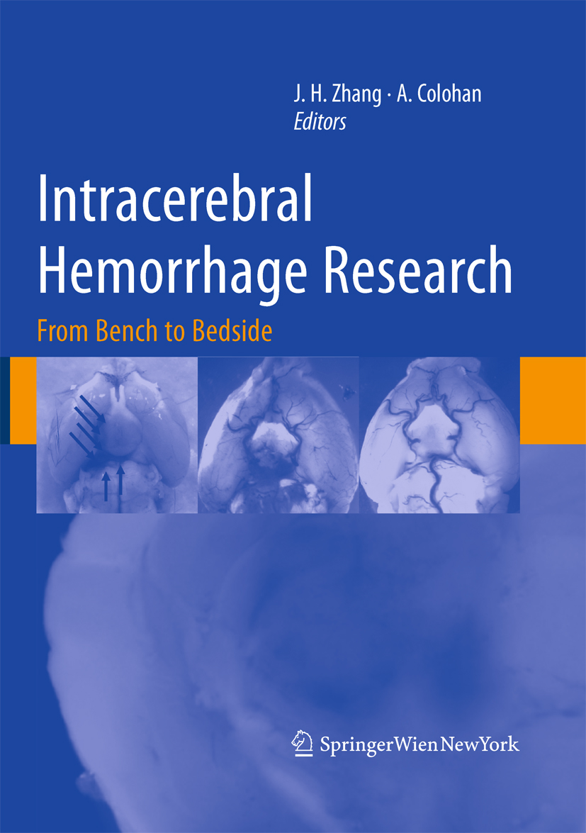 Intracerebral Hemorrhage Research