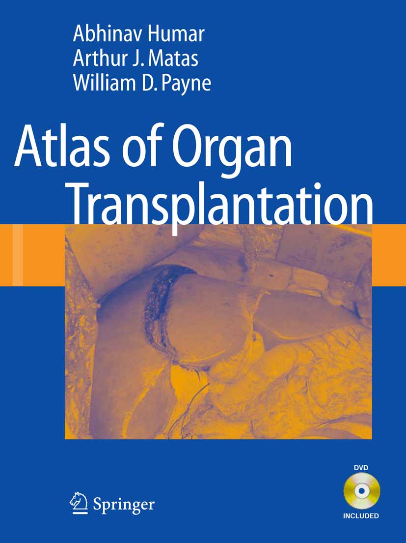 Cover Atlas of Organ Transplantation