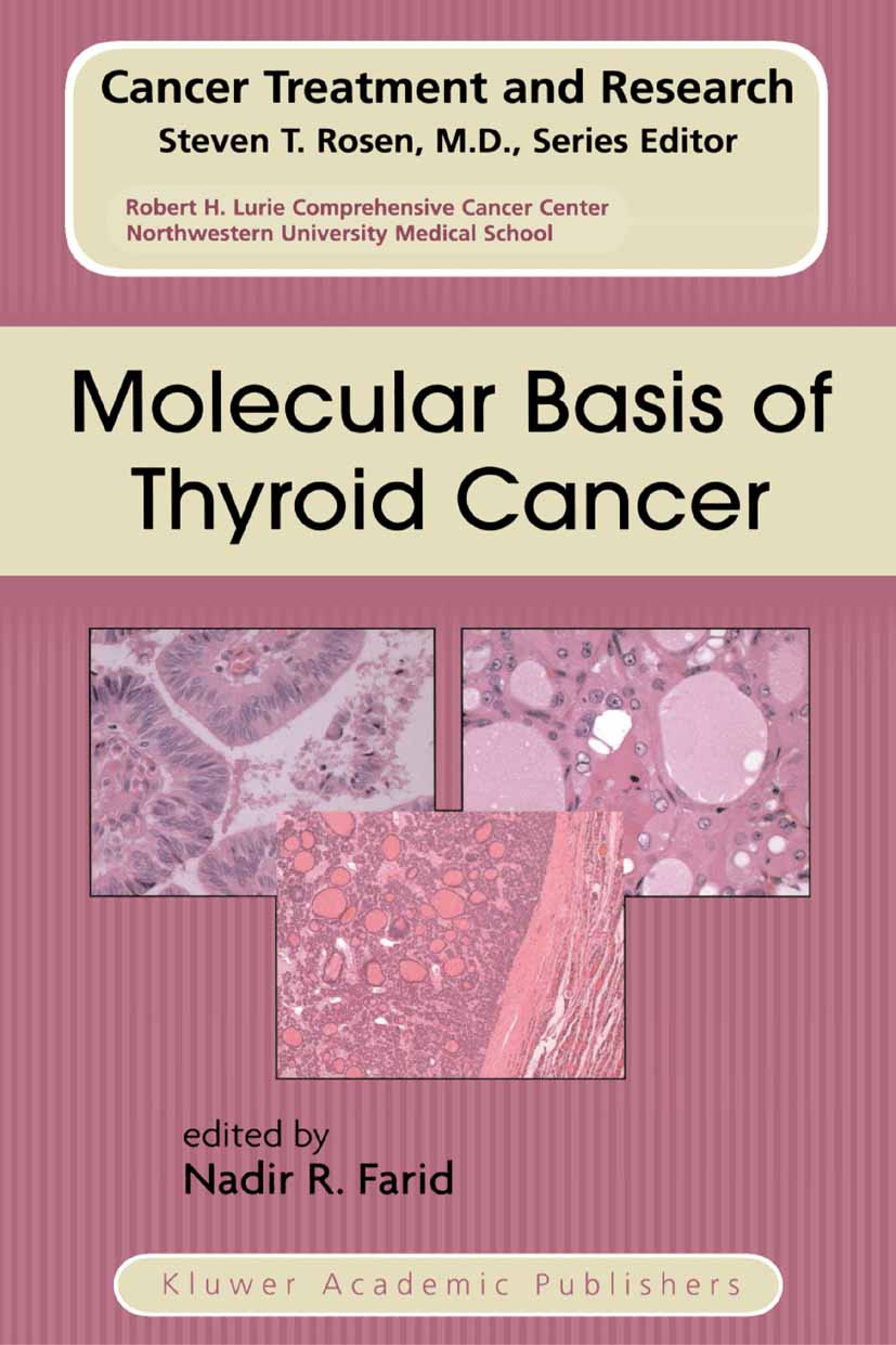 Cover Molecular Basis of Thyroid Cancer