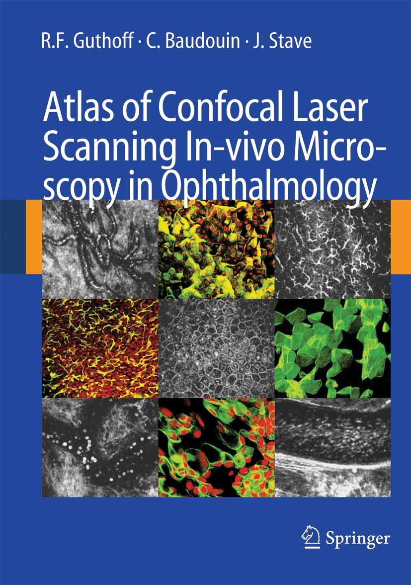 Cover Atlas of Confocal Laser Scanning In-vivo Microscopy in Ophthalmology