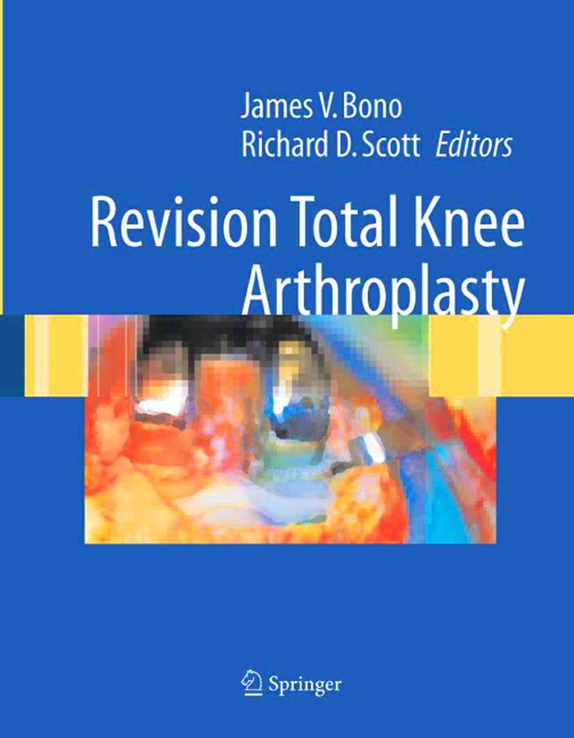 Cover Revision Total Knee Arthroplasty