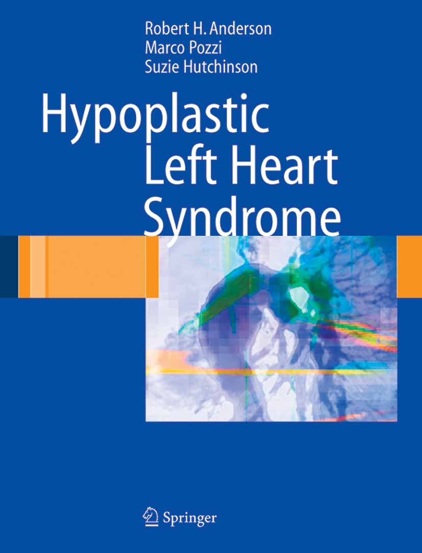 Cover Hypoplastic Left Heart Syndrome