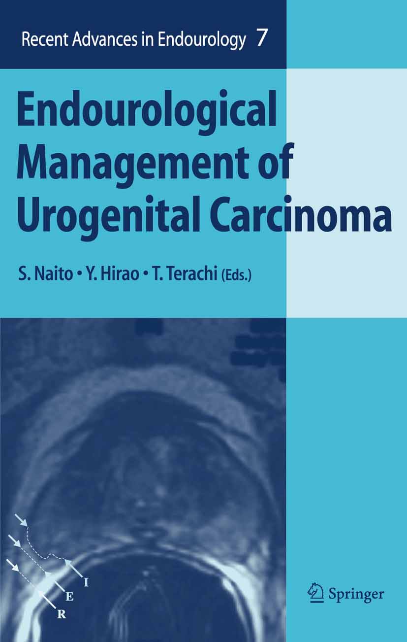 Cover Endourological Management of Urogenital Carcinoma