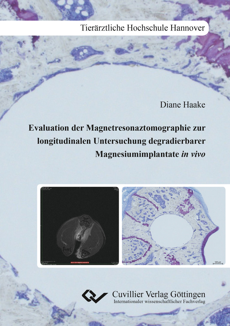 Cover Evaluation der Magnetresonaztomographie zur longitudinalen Untersuchung degradierbarer Mag-nesiumimplantate in vivo