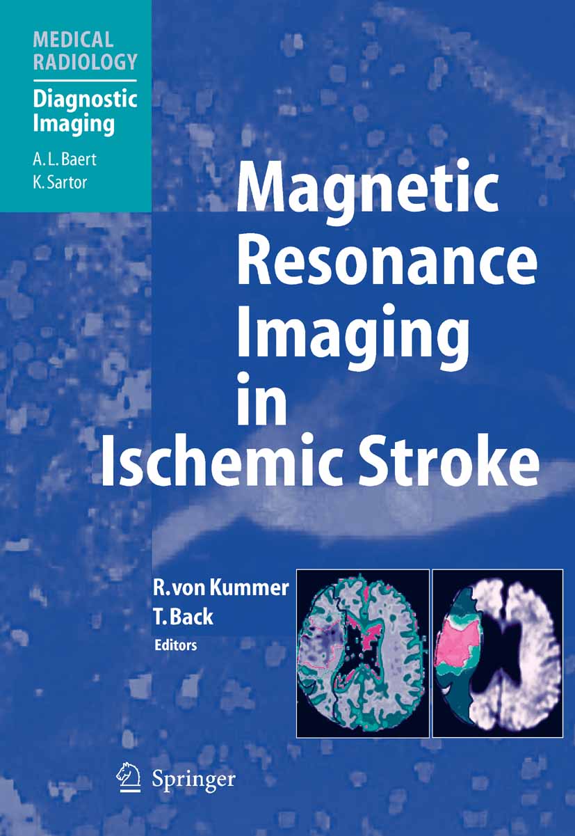Cover Magnetic Resonance Imaging in Ischemic Stroke
