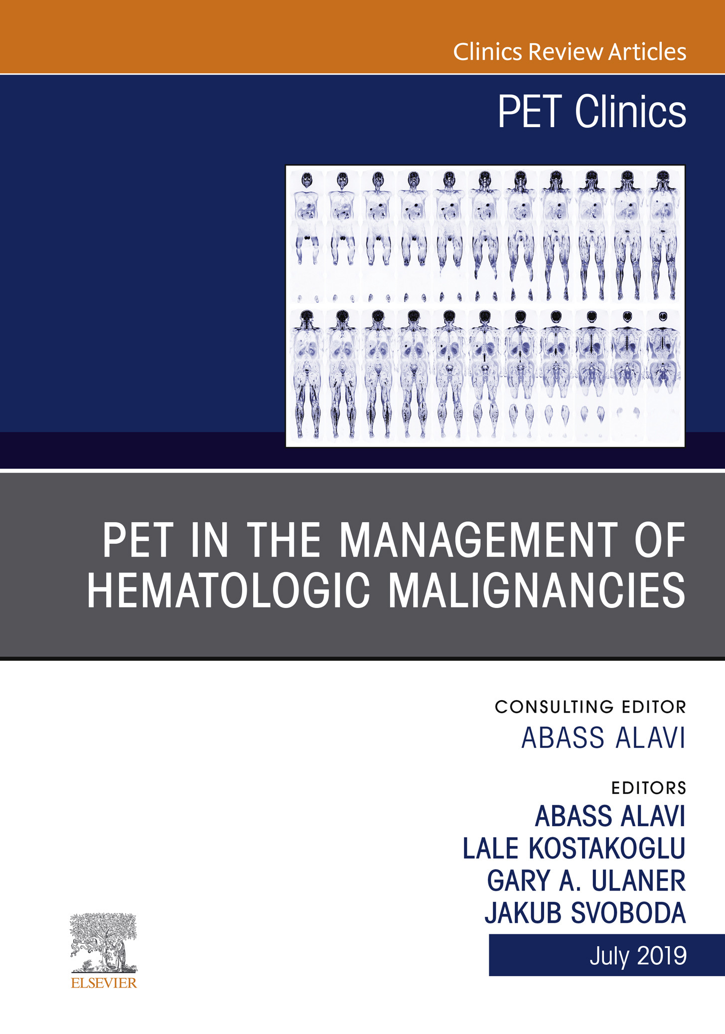 Cover PET in the Management of Hematologic Malignancies, An Issue of PET Clinics, E-Book