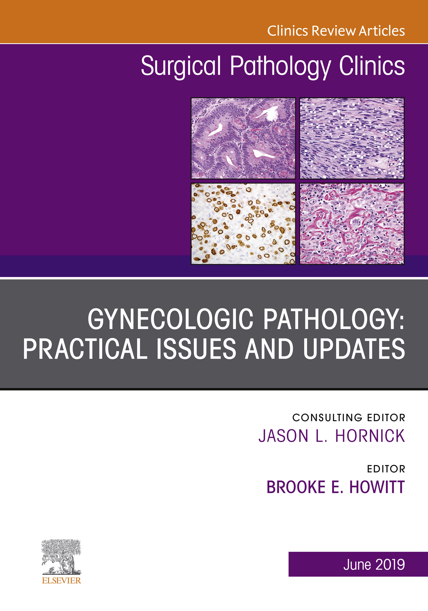 Gynecologic Pathology: Practical Issues And Updates, An Issue Of ...