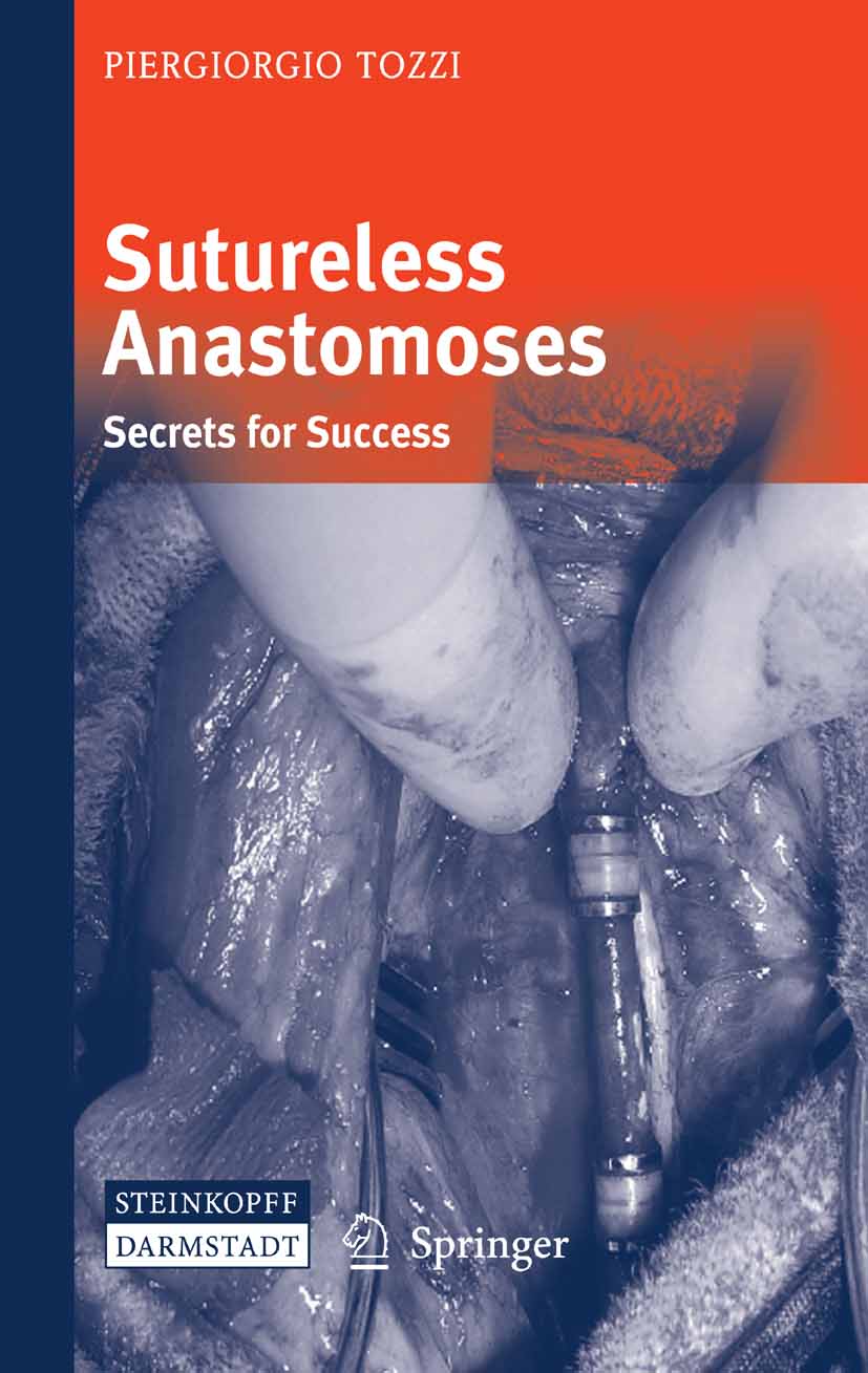Cover Sutureless Anastomoses