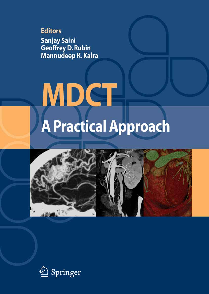 Cover MDCT: A Practical Approach