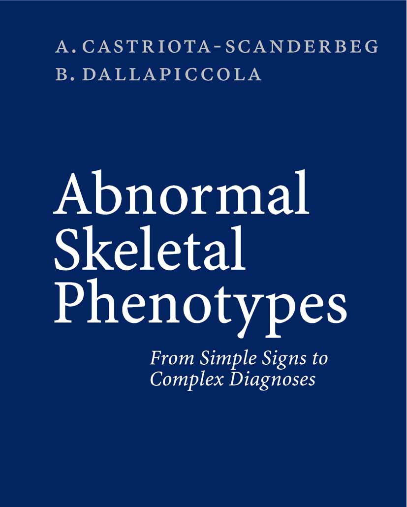 Cover Abnormal Skeletal Phenotypes