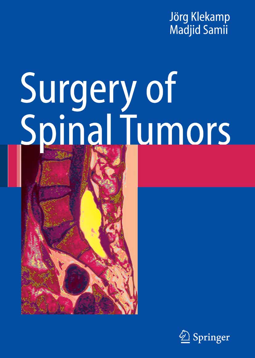 Cover Surgery of Spinal Tumors