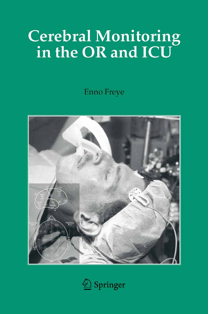 Cover Cerebral Monitoring in the OR and ICU