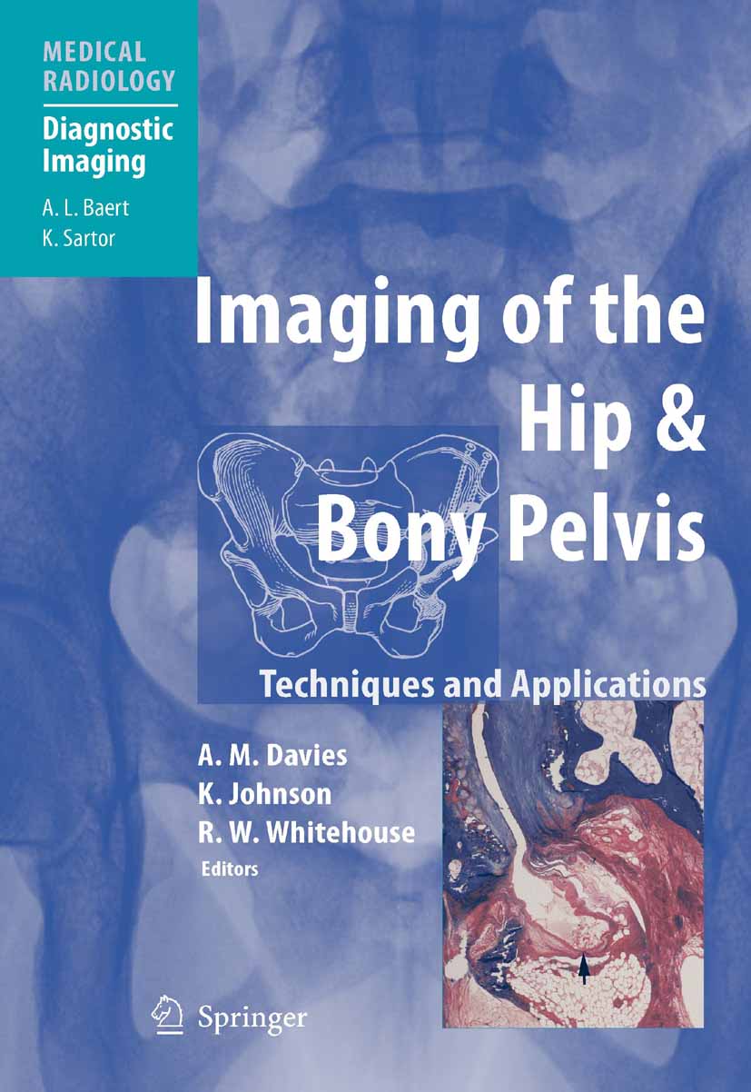 Cover Imaging of the Hip & Bony Pelvis