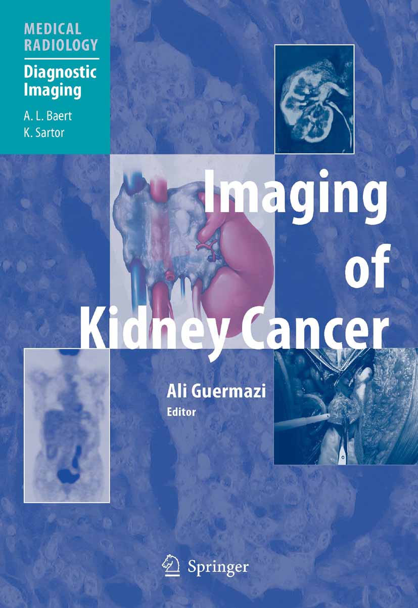 Cover Imaging of Kidney Cancer