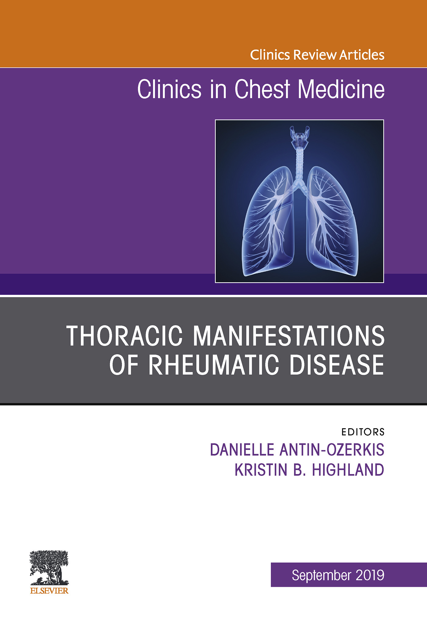 Thoracic Manifestations of Rheumatic Disease, An Issue of Clinics in Chest Medicine E-Book