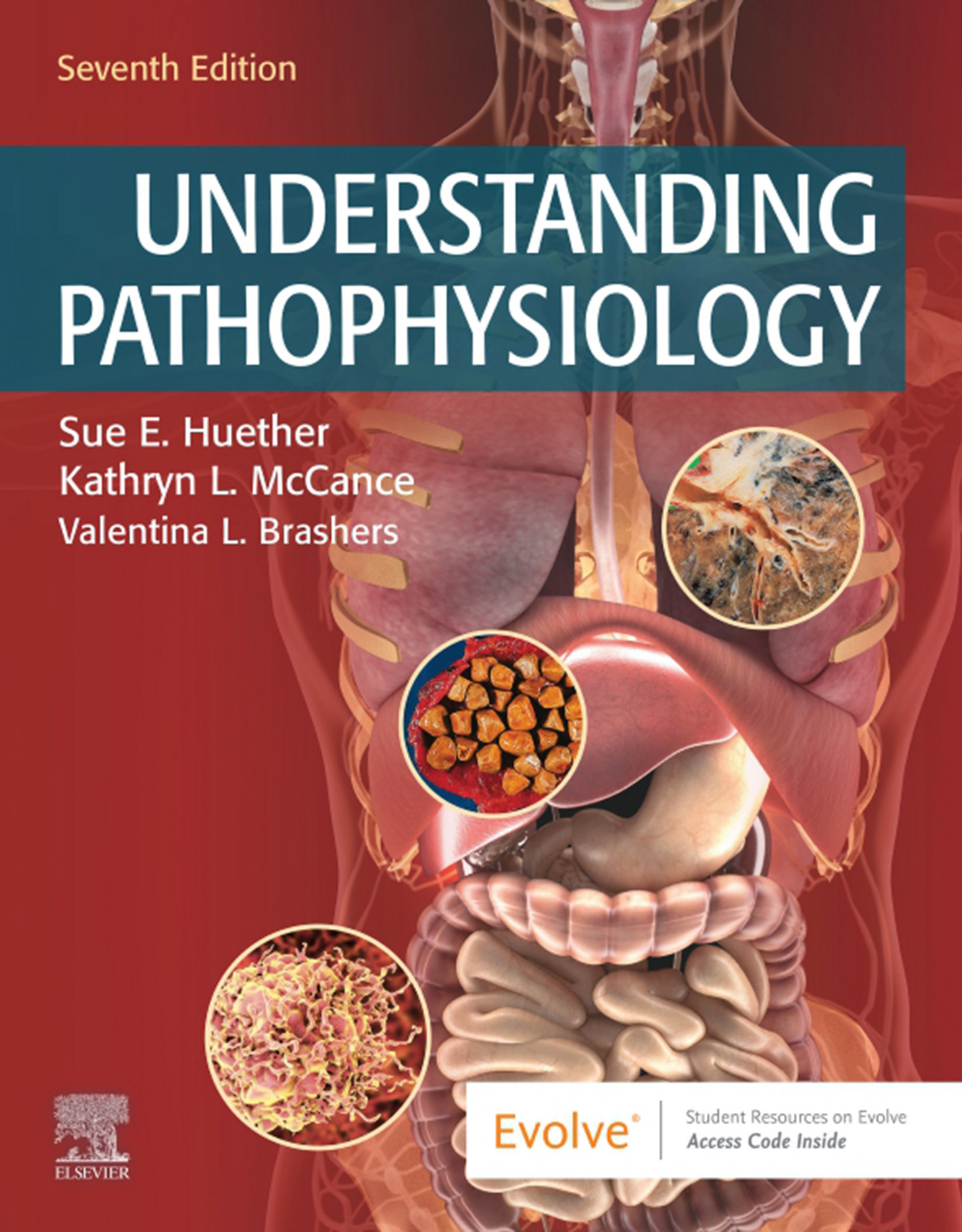 Cover Understanding Pathophysiology - E-Book