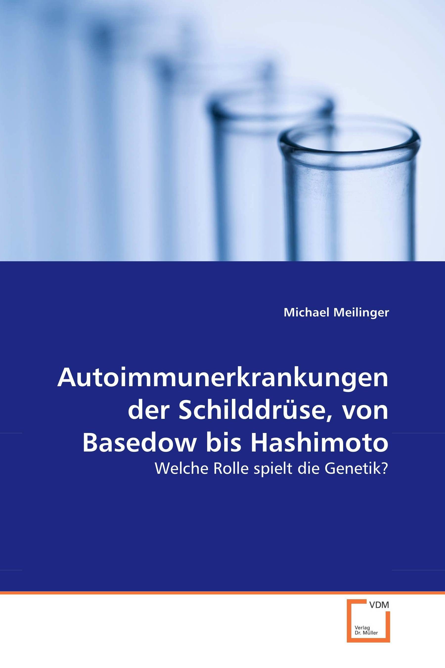 Cover Autoimmunerkrankungen der Schilddrüse, von Basedow bis Hashimoto