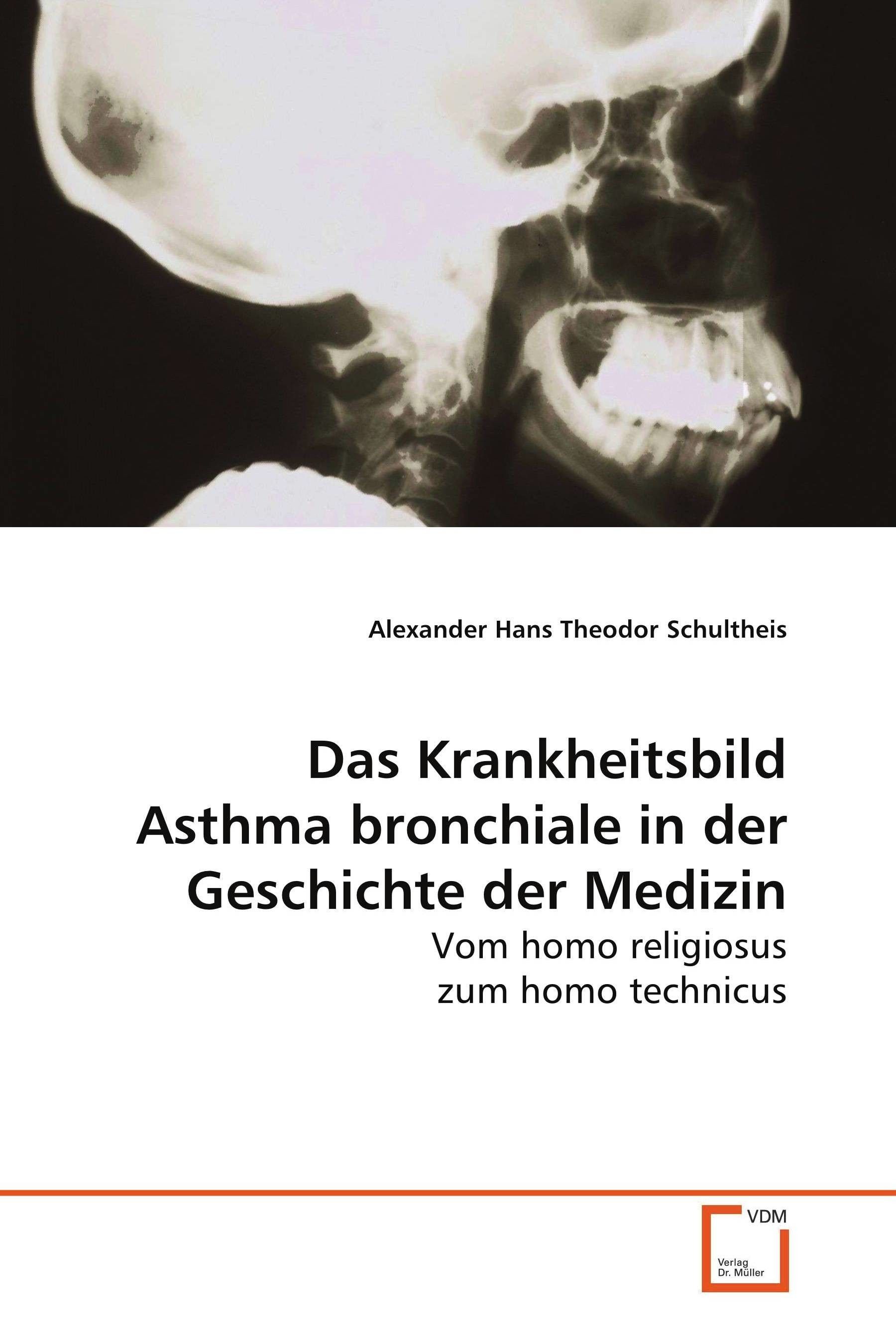 Cover Das Krankheitsbild Asthma bronchiale in der Geschichte der Medizin