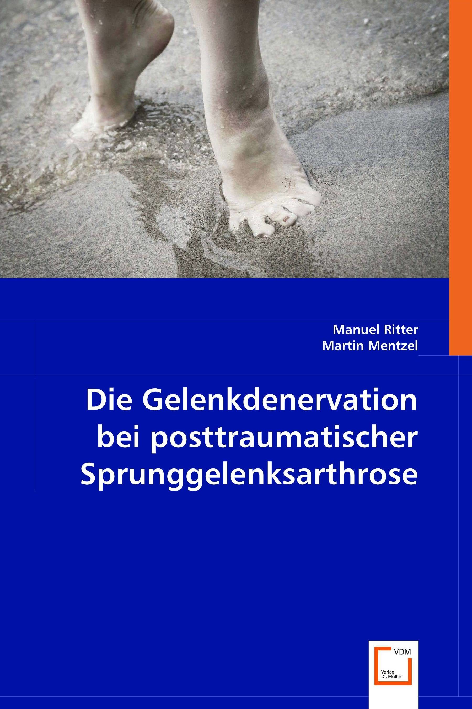 Cover Die Gelenkdenervation beiposttraumatischer Sprunggelenksarthrose