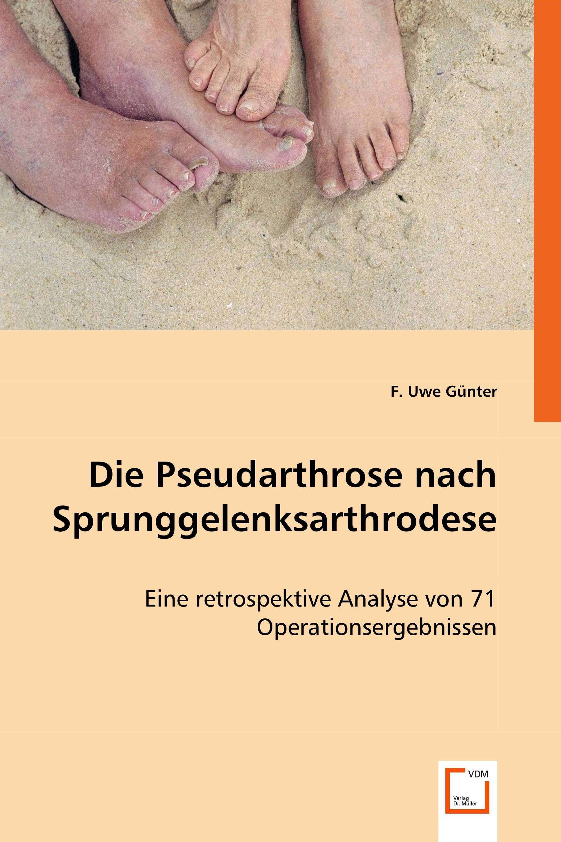 Cover Die Pseudarthrose nach Sprunggelenksarthrodese