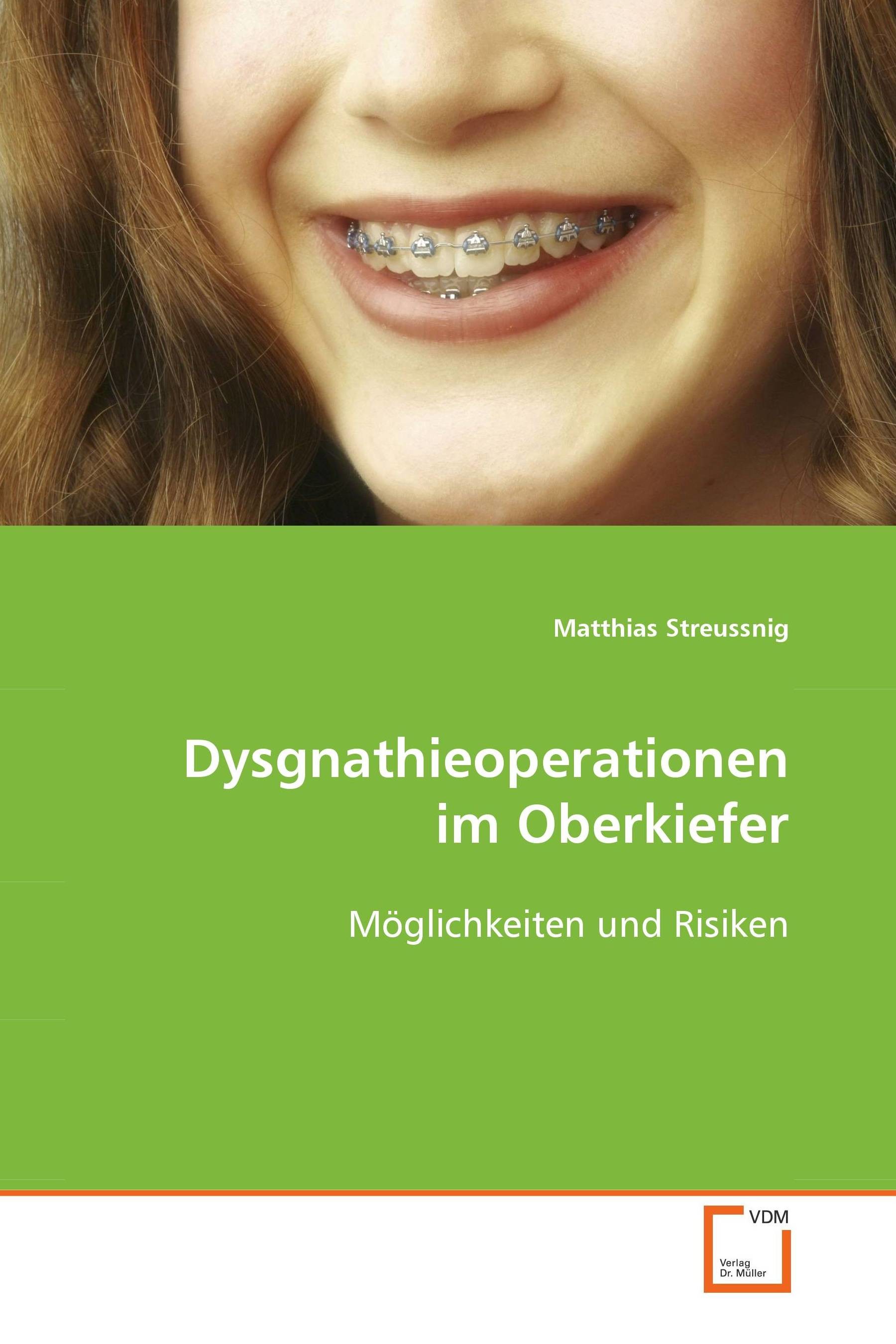 Cover Dysgnathieoperationen im Oberkiefer