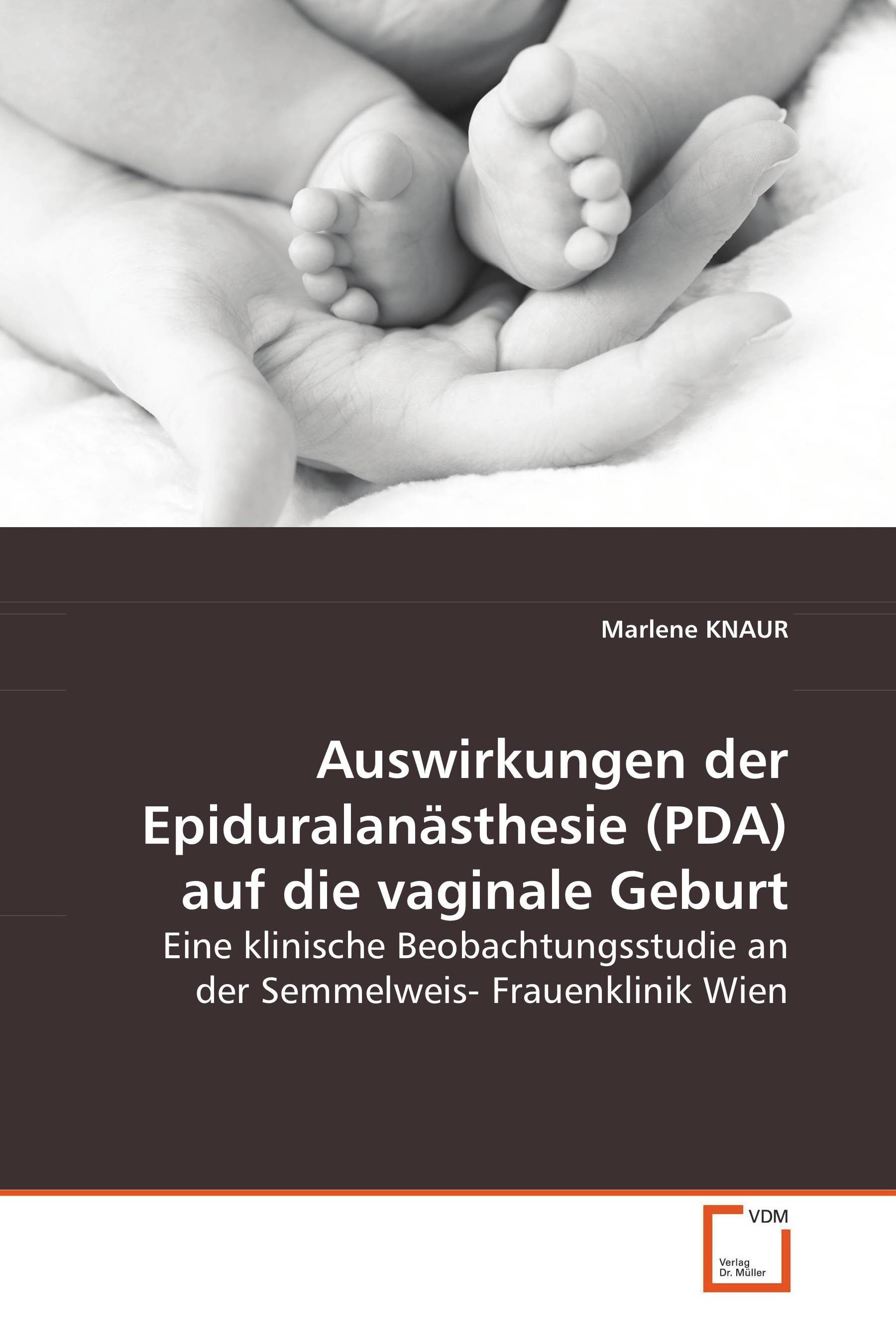 Auswirkungen der Epiduralanästhesie (PDA) auf dievaginale Geburt