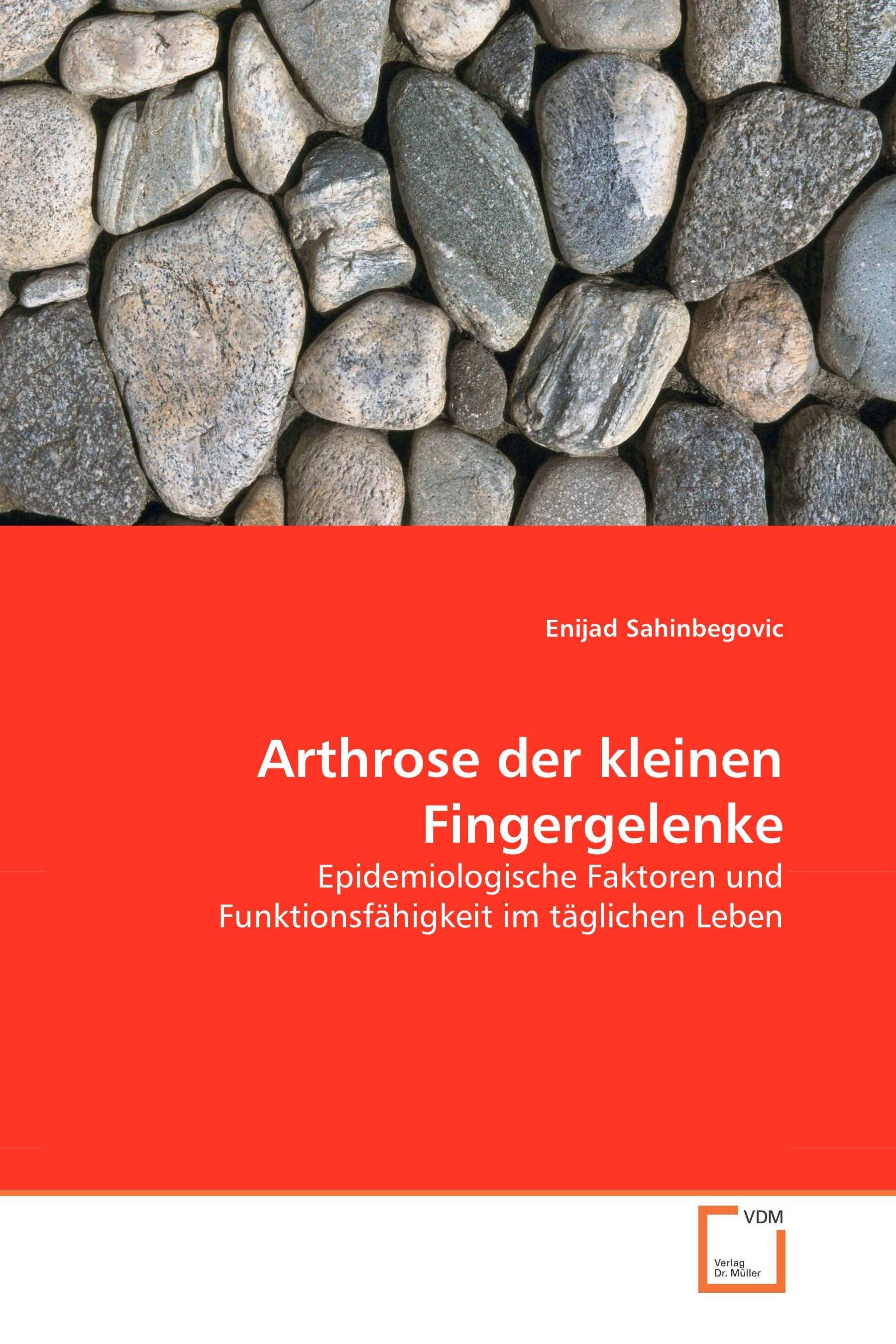 Cover Arthrose der kleinen Fingergelenke