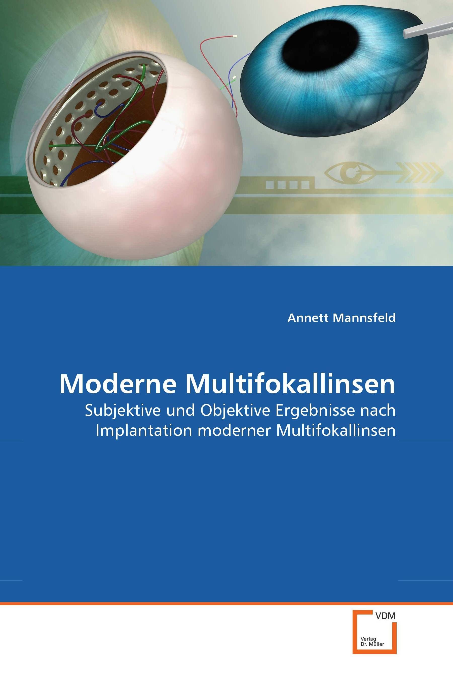 Cover Moderne Multifokallinsen