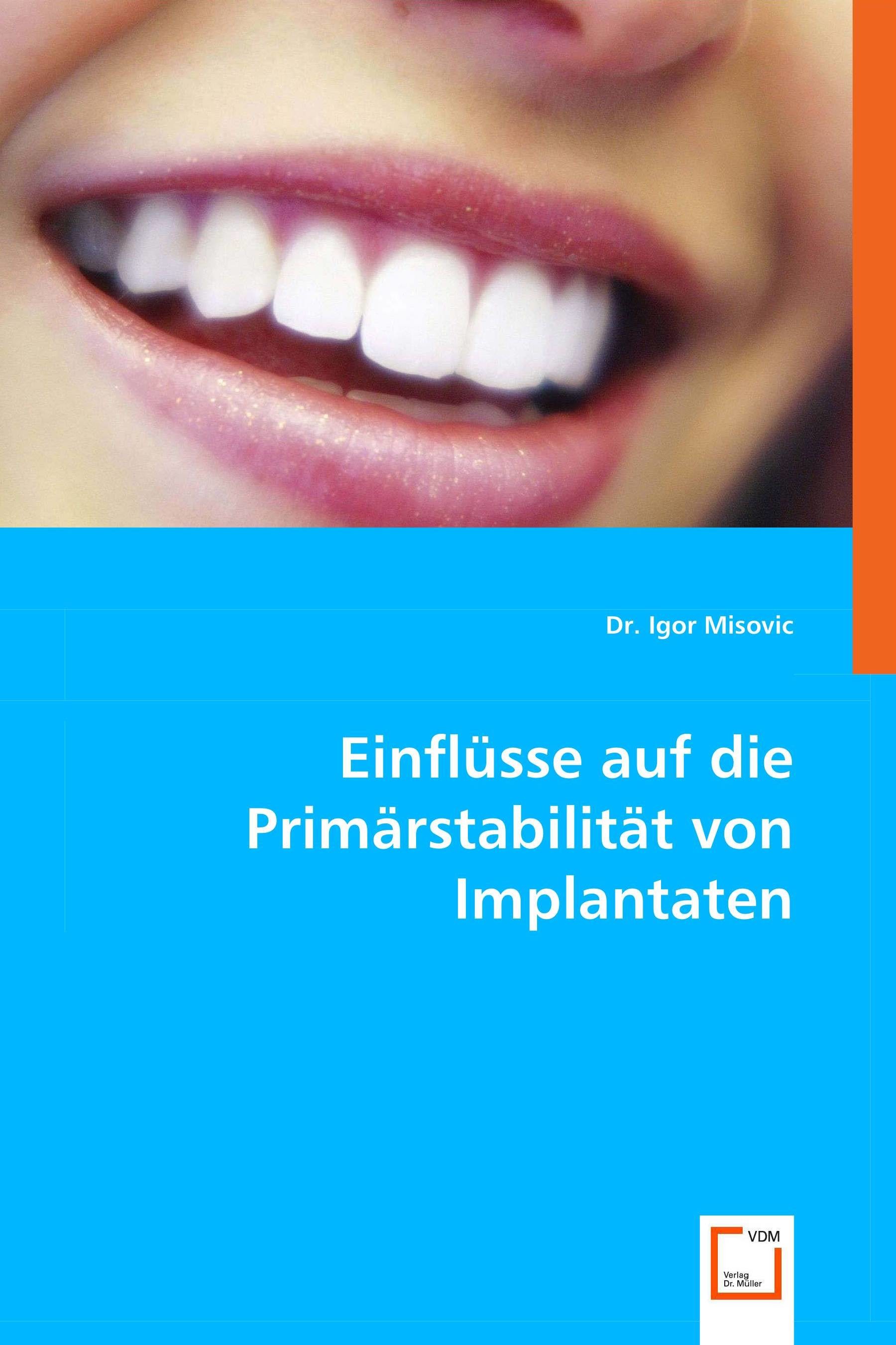Cover Einflüsse auf die Primärstabilität von Implantaten