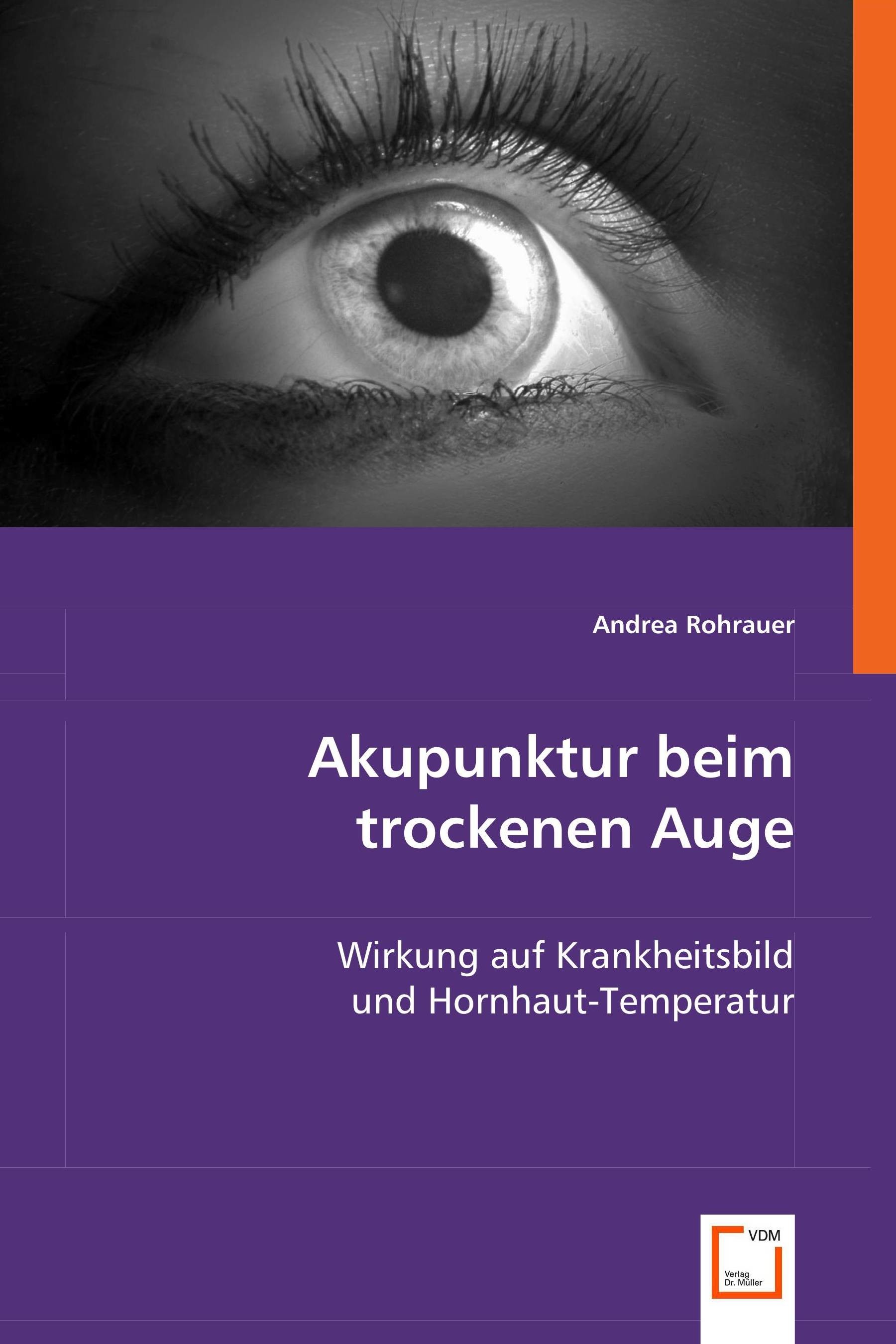 Cover Akupunktur beim trockenen Auge