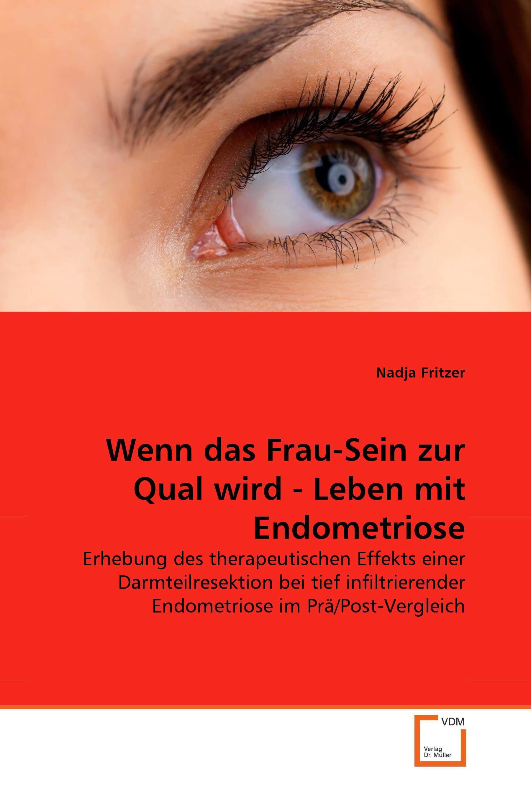 Cover Wenn das Frau-Sein zur Qual wird - Leben mit Endometriose