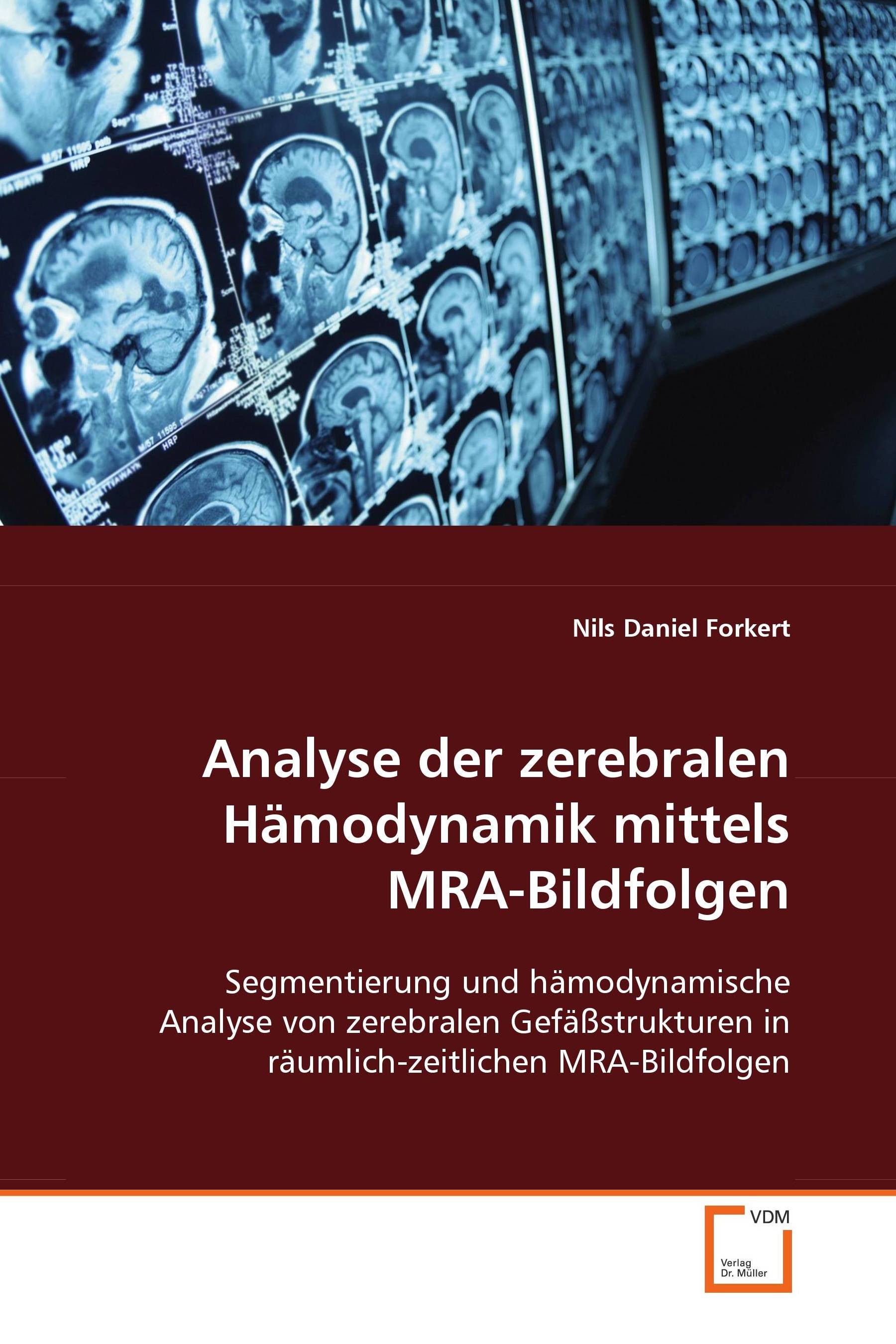 Cover Analyse der zerebralen Hämodynamik mittels MRA-Bildfolgen