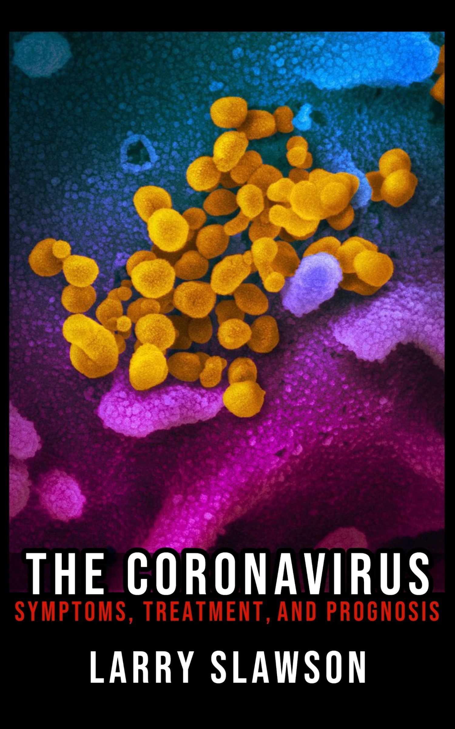 The Coronavirus