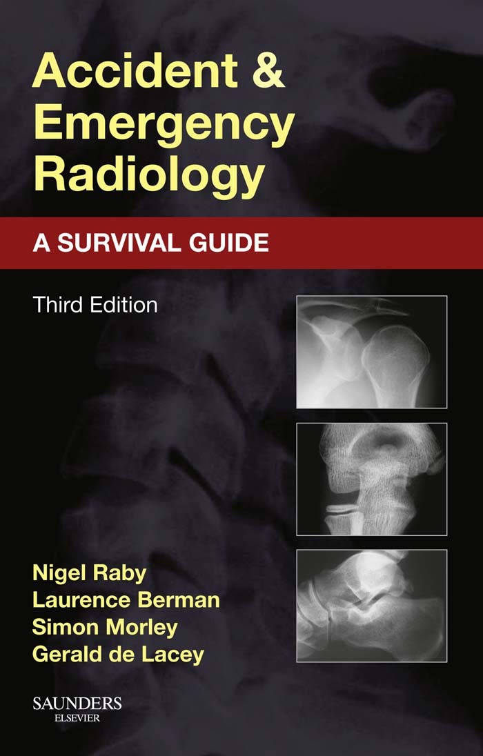 Cover Accident and Emergency Radiology: A Survival Guide E-Book