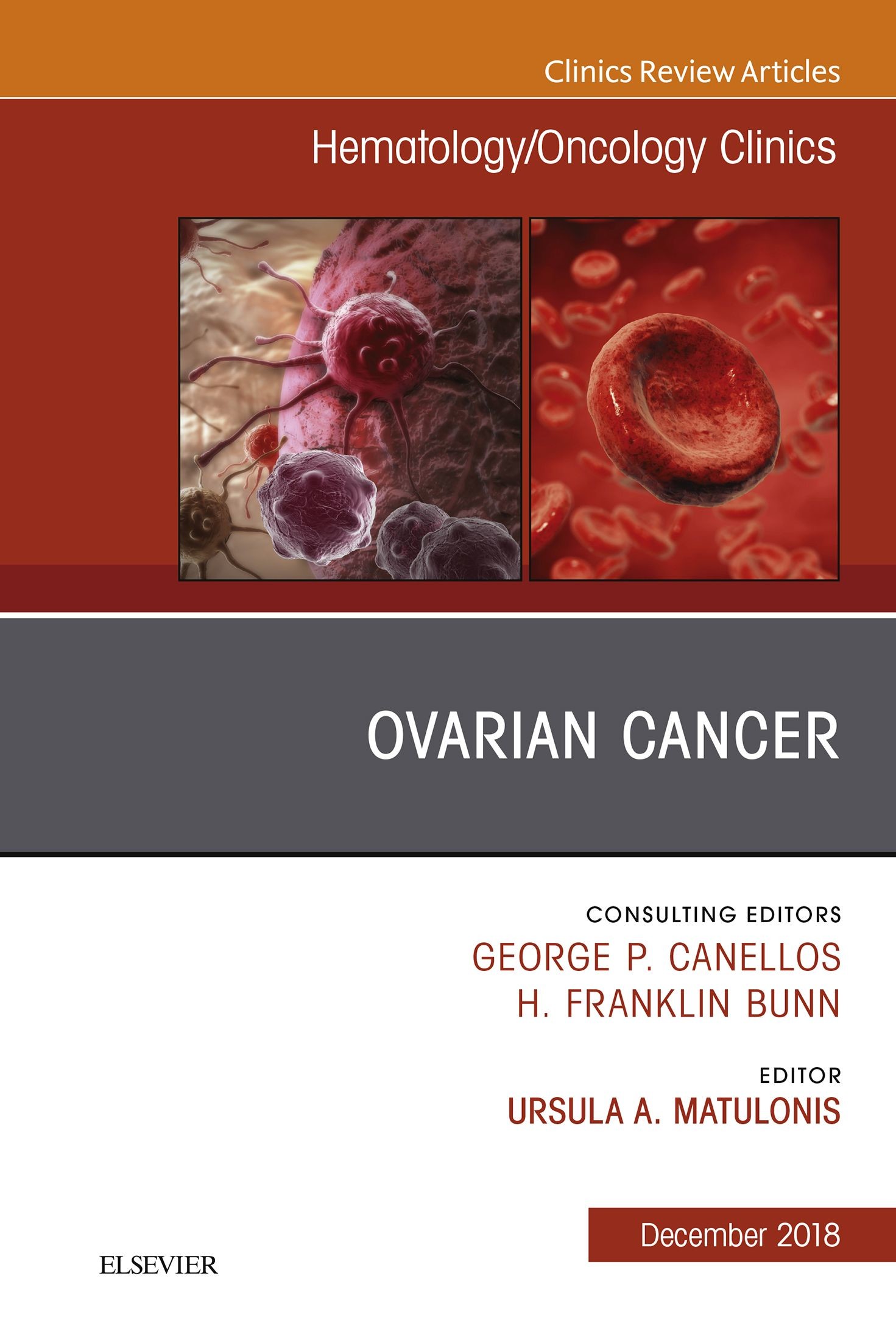 Cover Ovarian Cancer, An Issue of Hematology/Oncology Clinics of North America E-Book