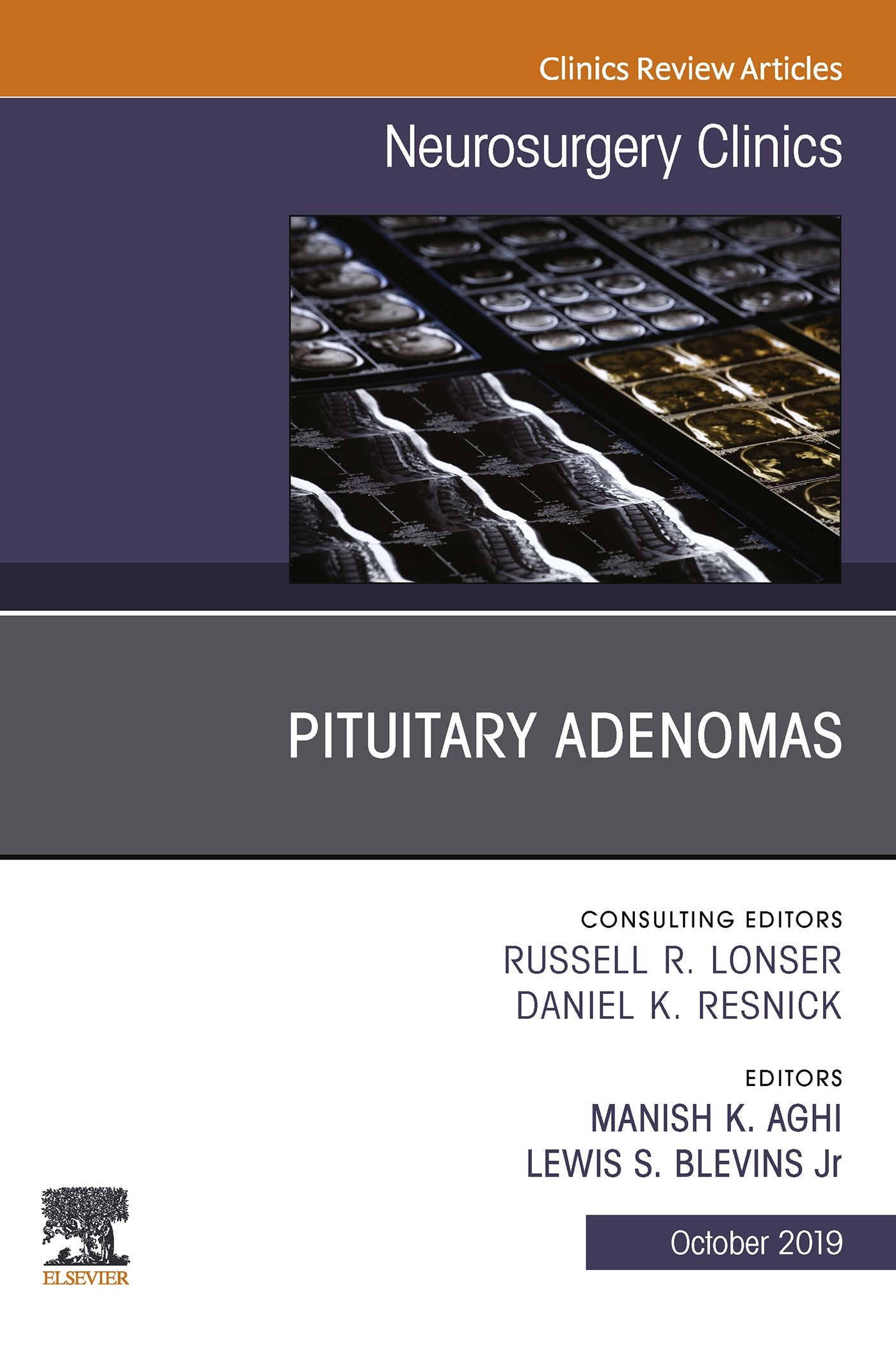 Pituitary Adenoma, An Issue of Neurosurgery Clinics of North America E-Book