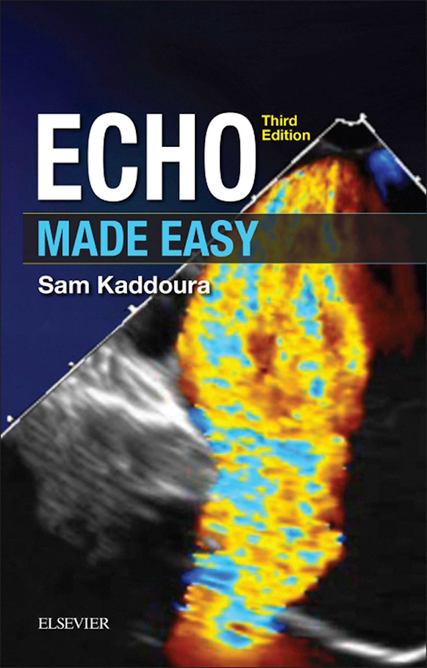 Cover Echo Made Easy E-Book