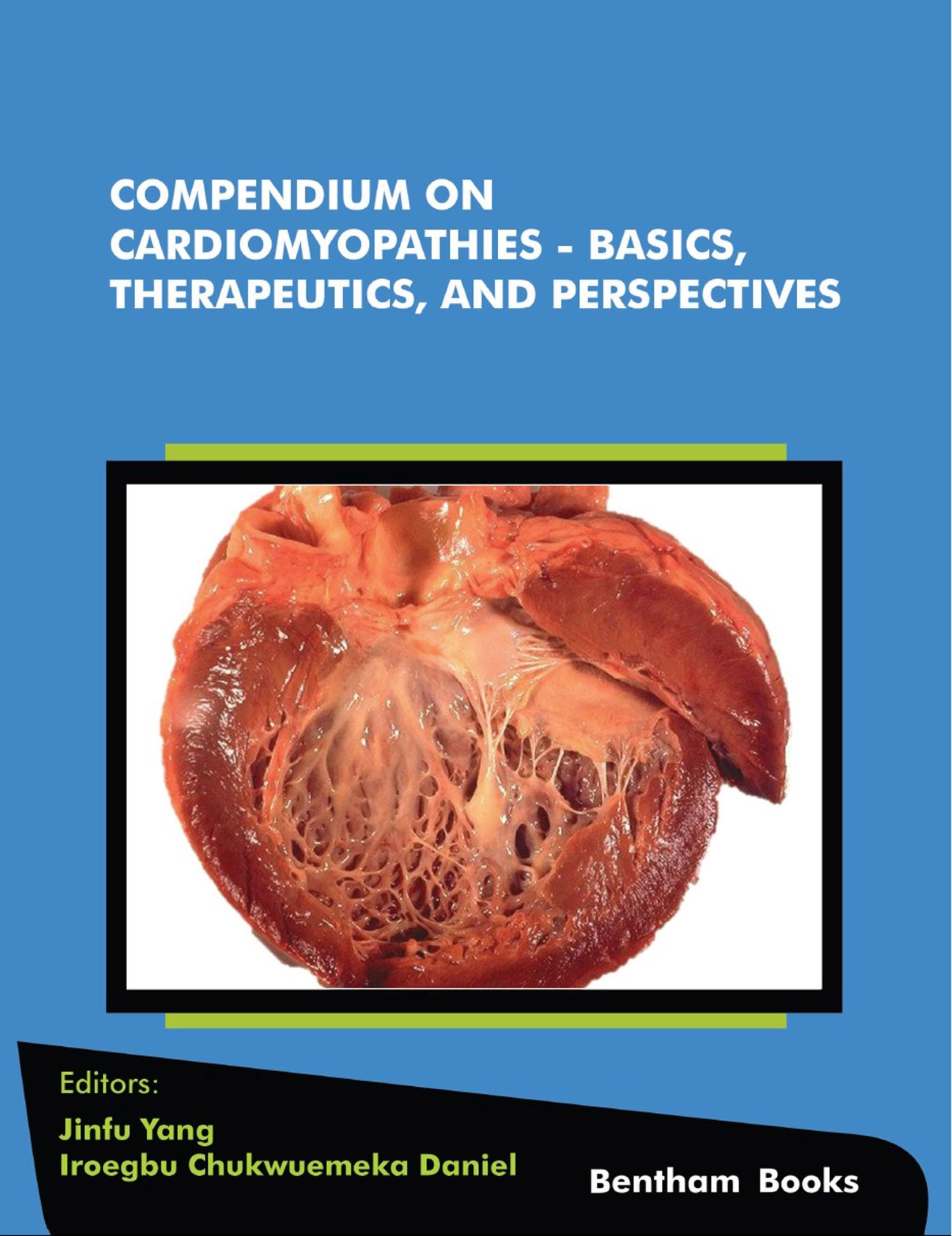 Cover Compendium on Cardiomyopathies - Basics, Therapeutics, and Perspectives