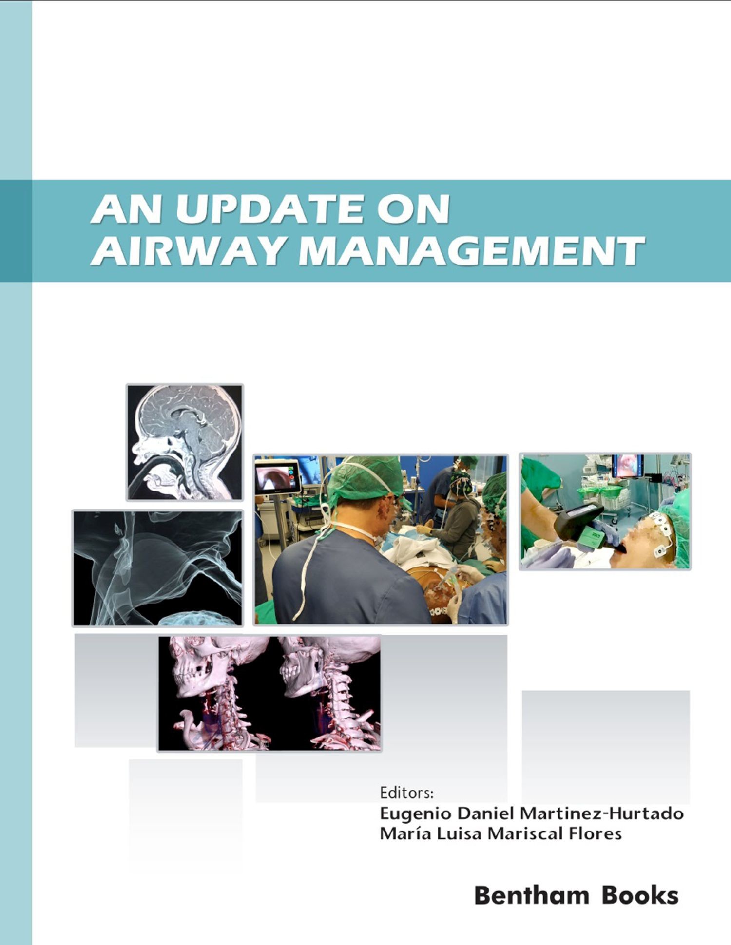 Cover An Update on Airway Management
