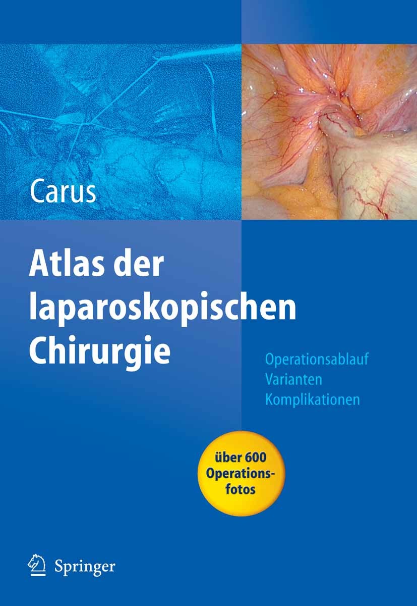 Cover Operationsatlas Laparoskopische Chirurgie