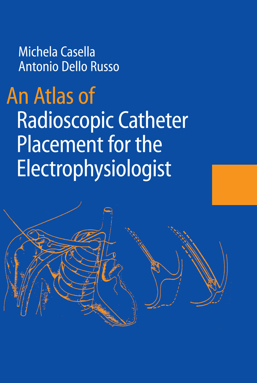 Cover An Atlas of Radioscopic Catheter Placement for the Electrophysiologist