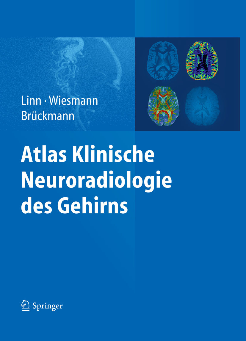 Cover Atlas Klinische Neuroradiologie des Gehirns