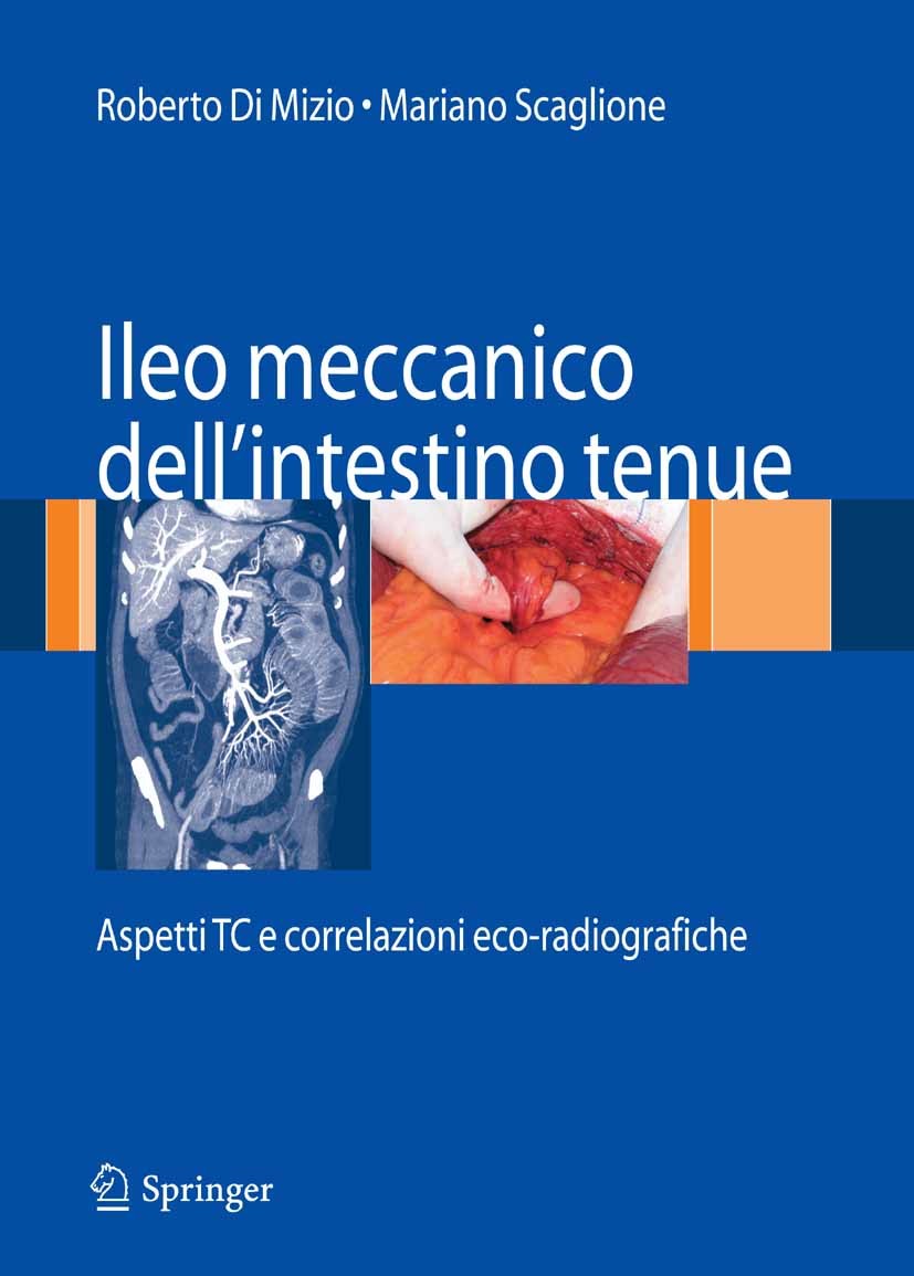 Ileo meccanico dell'intestino tenue