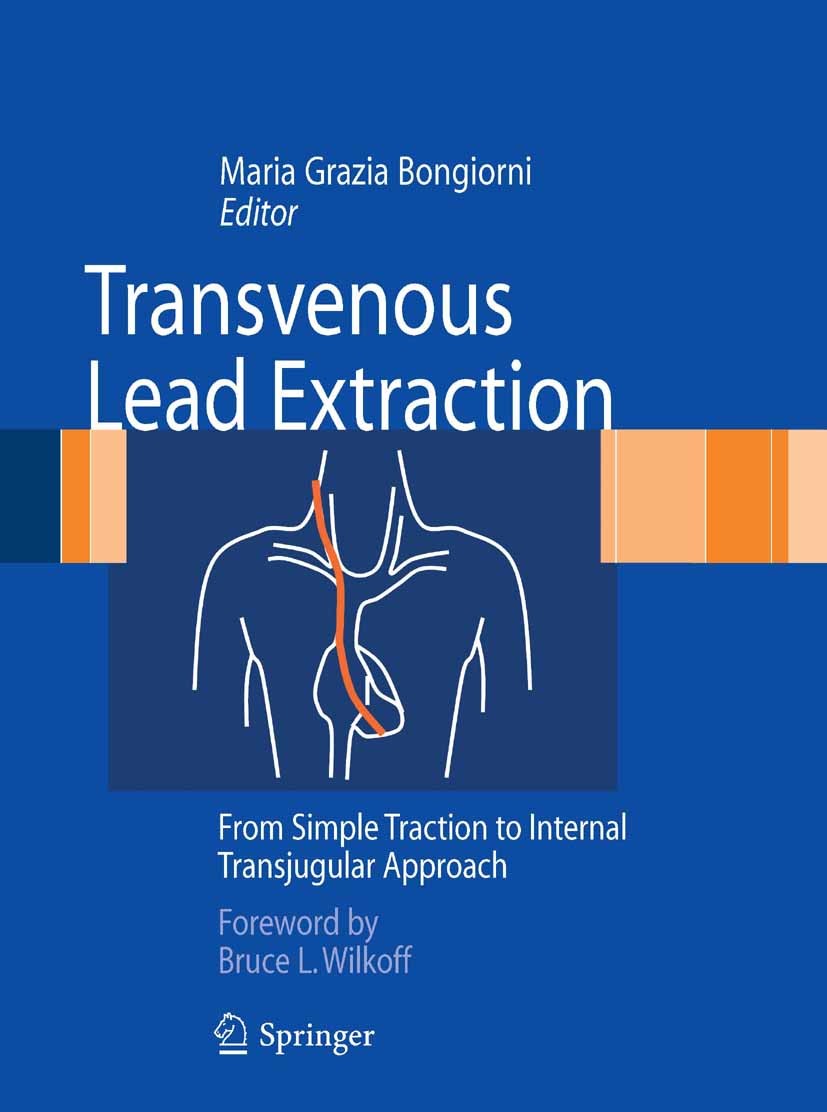 Cover Transvenous Lead Extraction