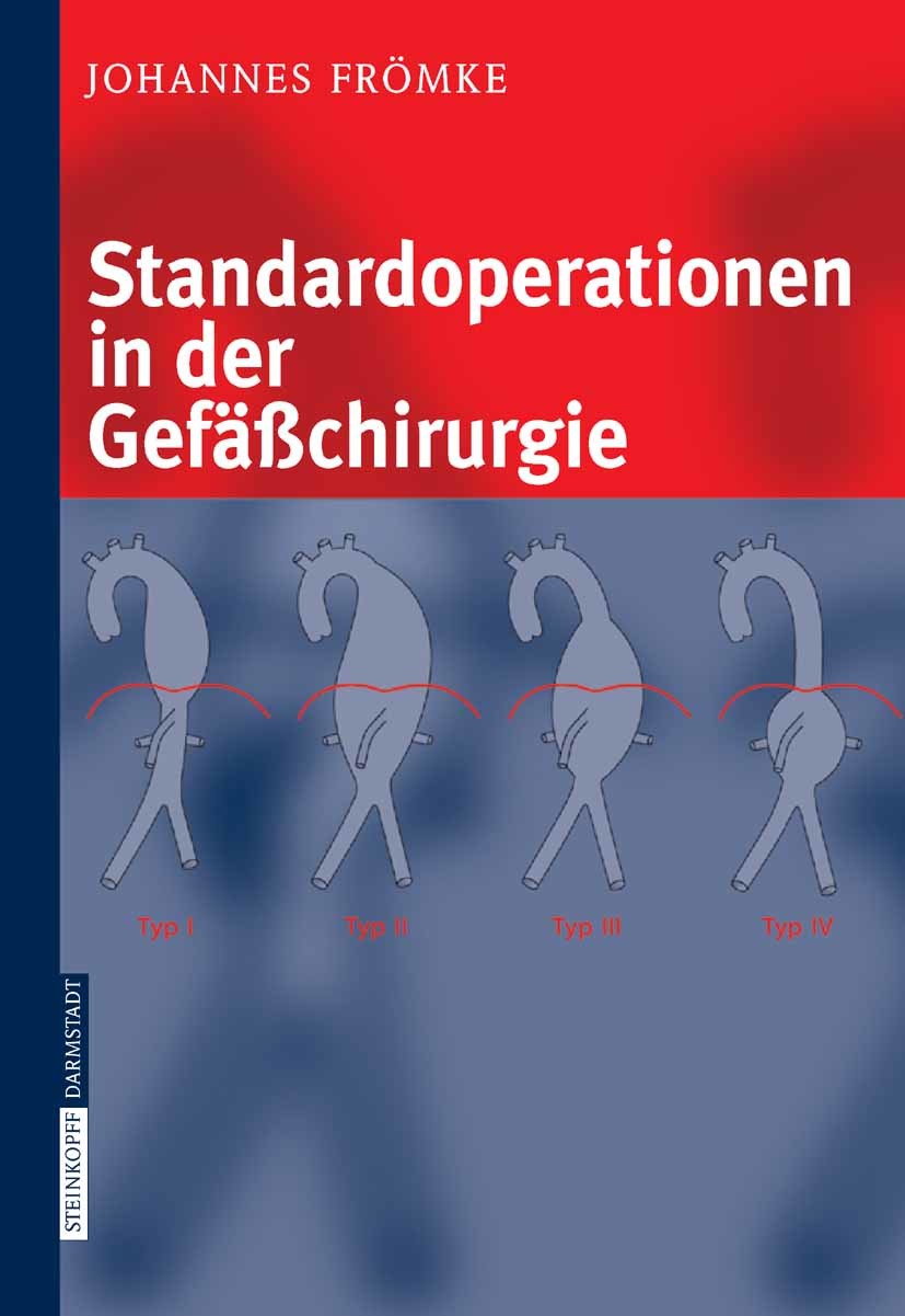 Cover Standardoperationen in der Gefäßchirurgie