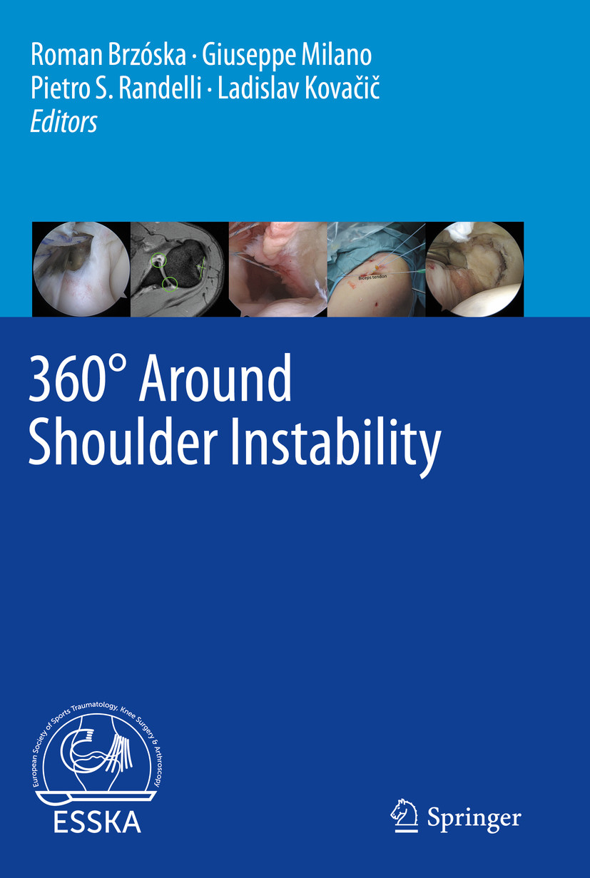Cover 360° Around Shoulder Instability