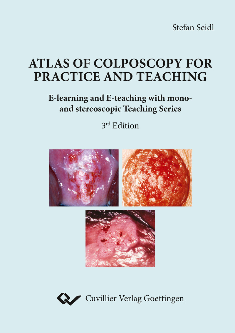 Cover Atlas of Colposcopy for Practice and Teaching