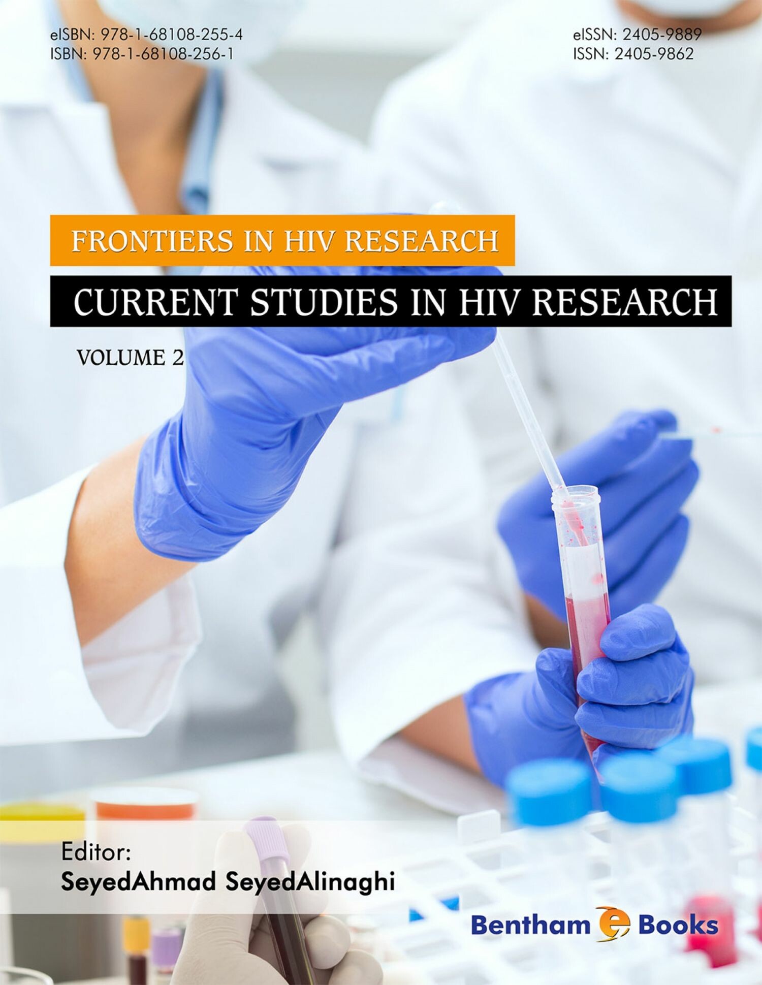 current research in hiv